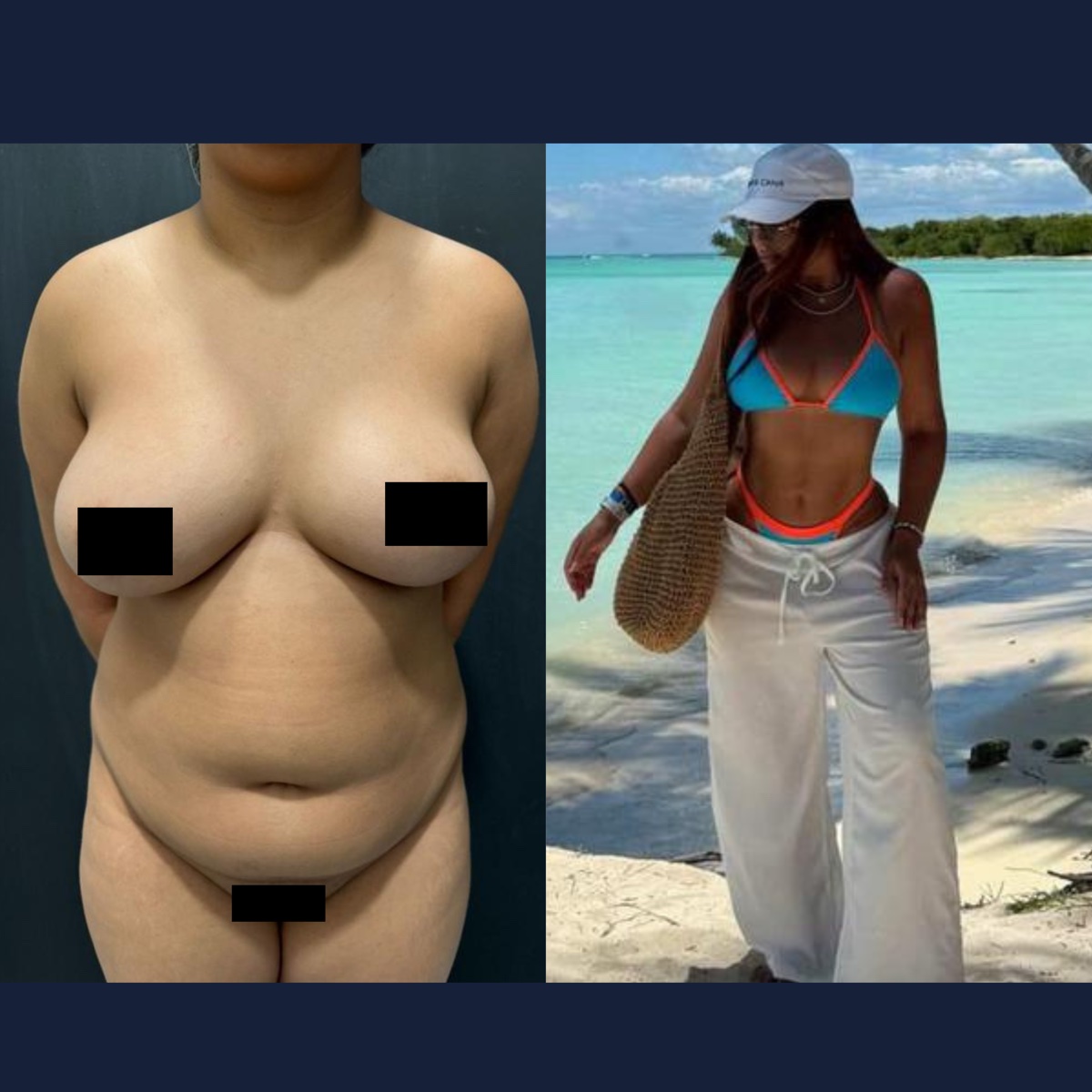 Antes e depois — caso 2