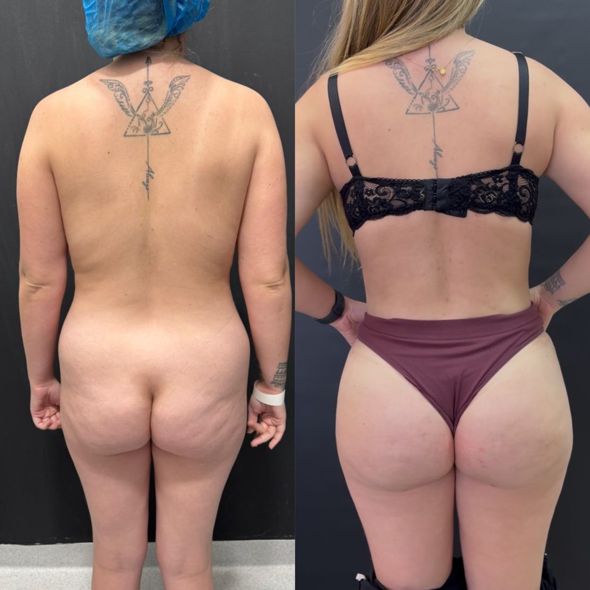 Antes e depois — caso 3