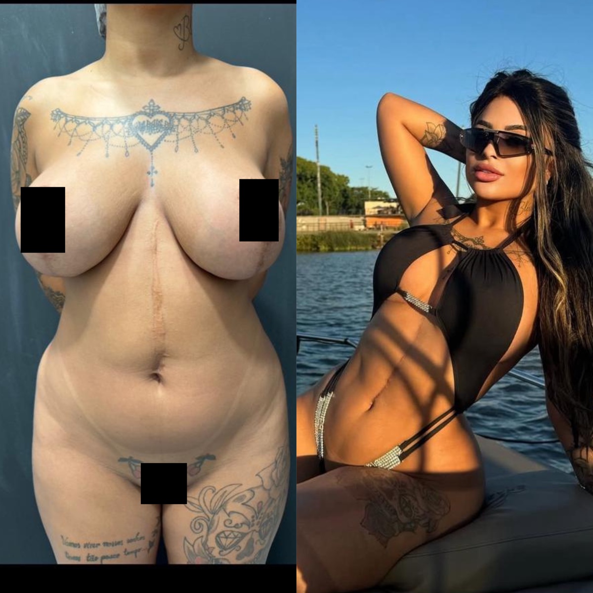 Antes e depois — caso 4