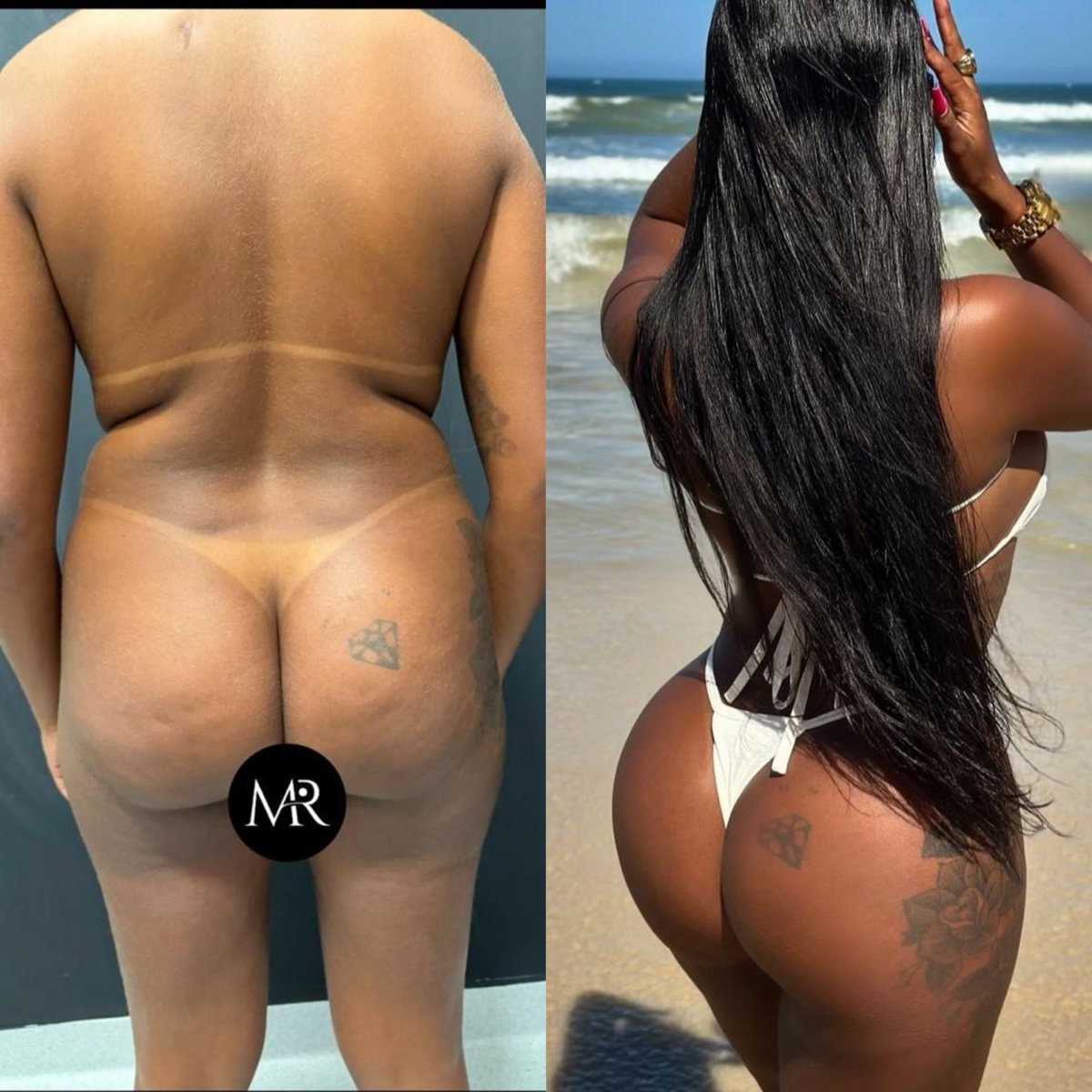 Antes e depois — caso 5