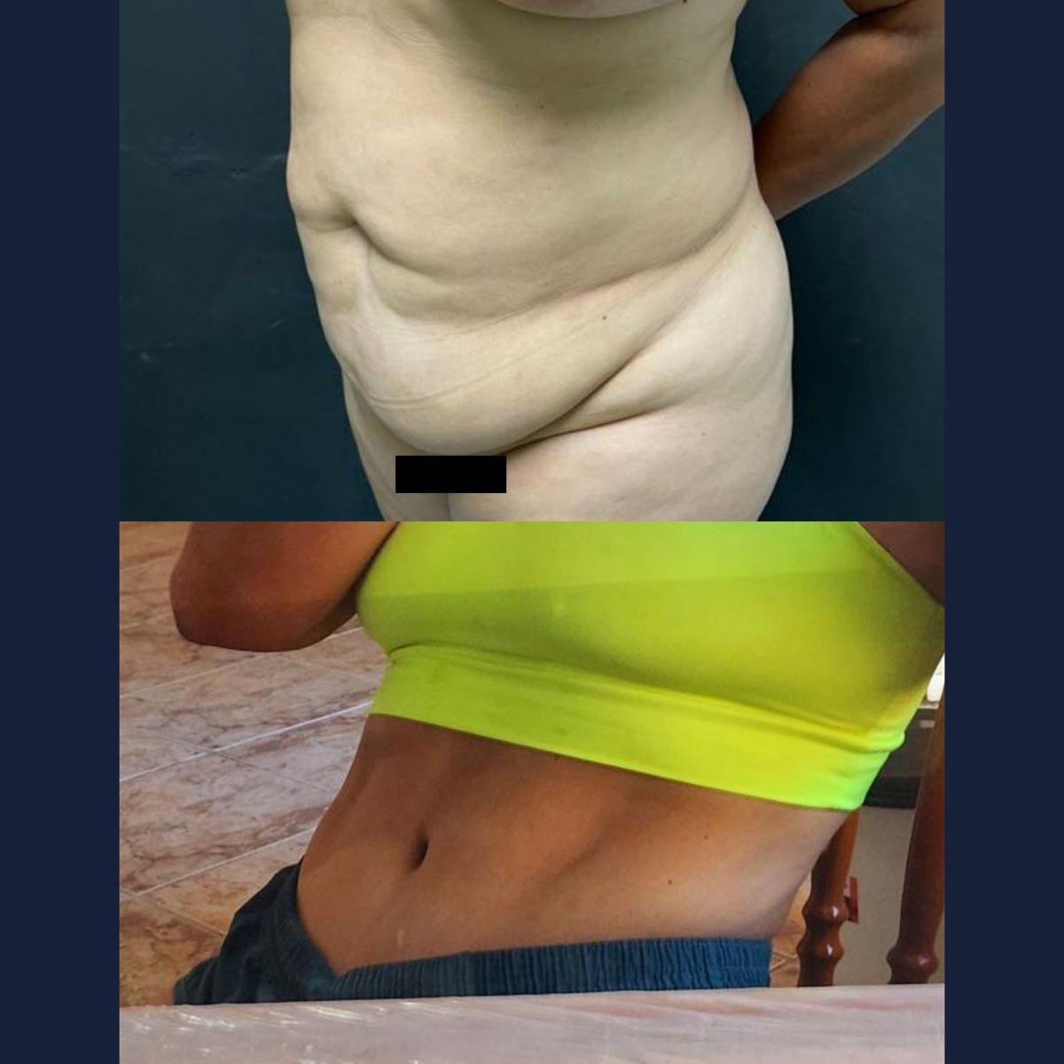 Antes e depois — caso 8